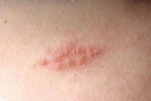 صورة تعبيرية