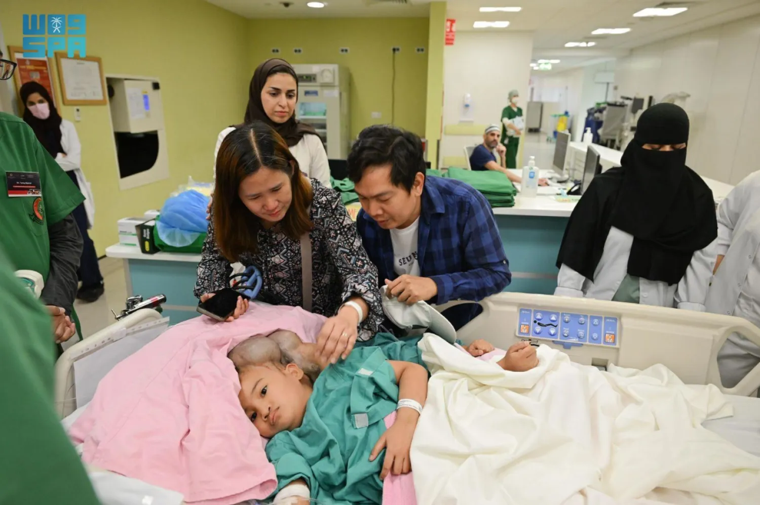 الرياض تبدأ فصل إحدى أكثر حالات التوائم تعقيداً في العالم