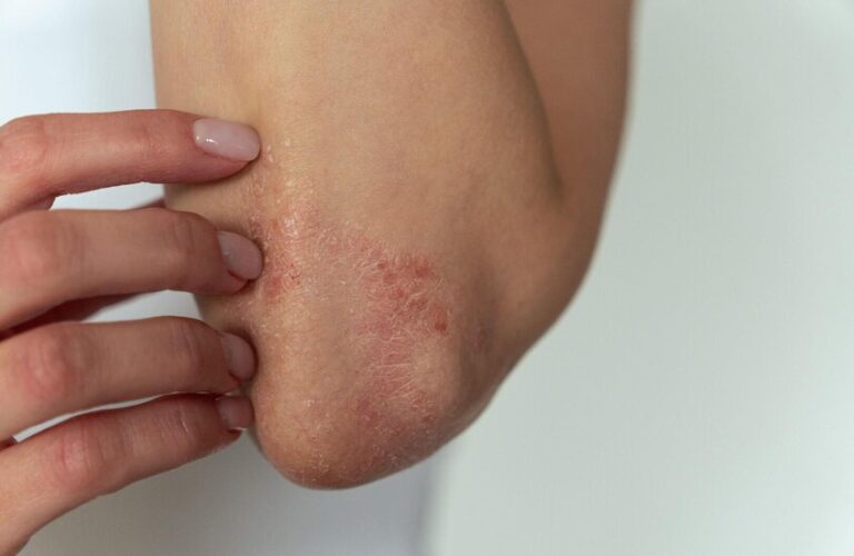 E2196D84-7B40-400A-B5D7-35A795EC3D11